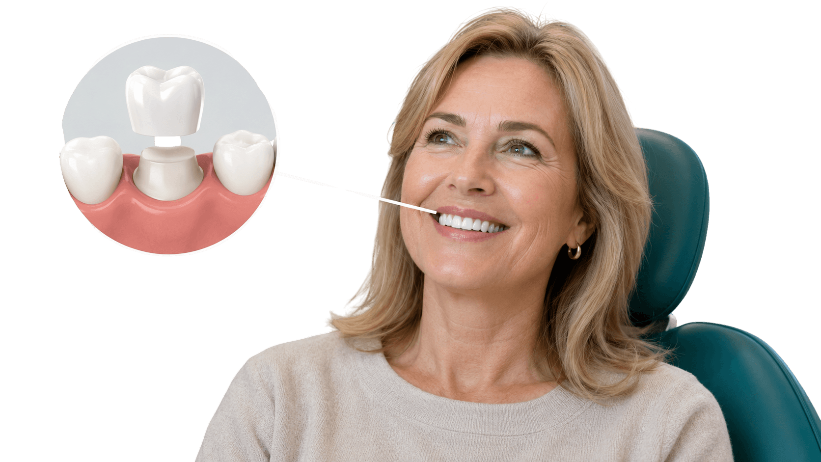 Custom dental crown restoration at York House Dental Practice, West Byfleet