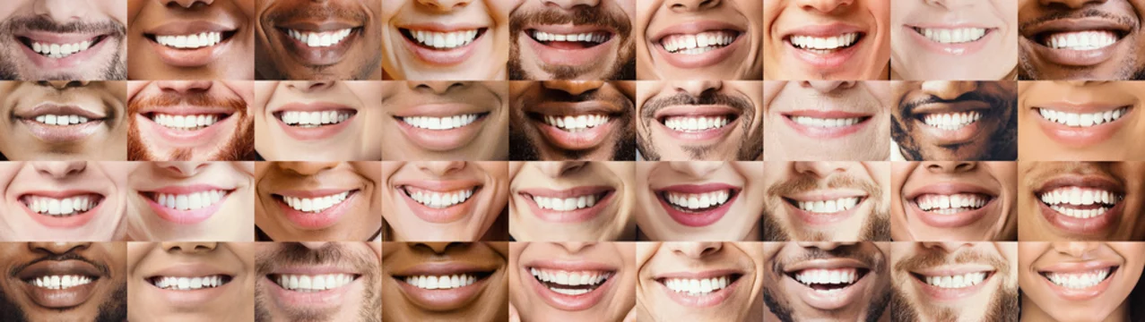 Teeth Whitening 1 2025 December Teeth Whitening in West Byfleet