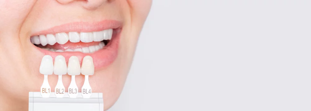 Dental Veneers in West Byfleet
