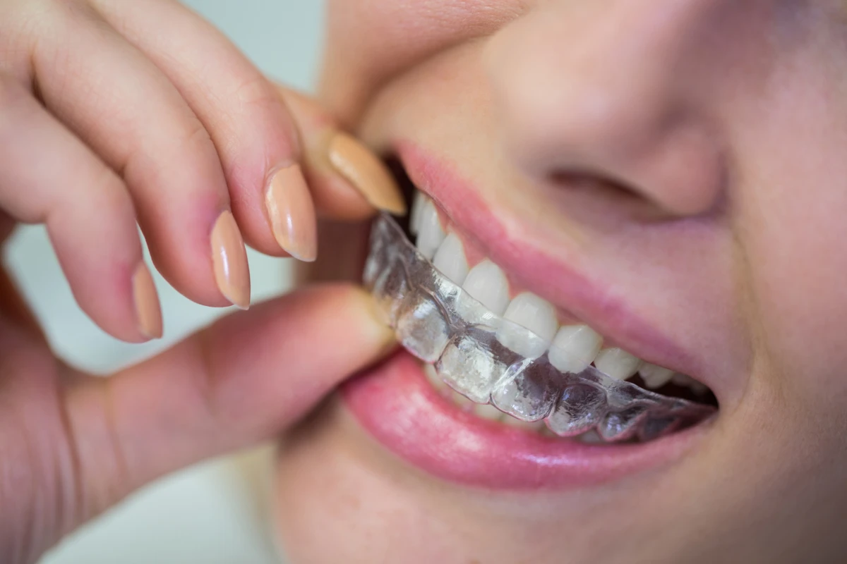 Invisalign & Orthodontics