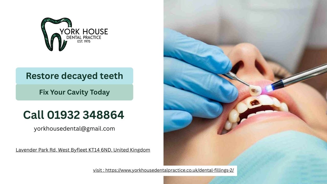 Dental Fillings 2 2025 December Dental Fillings