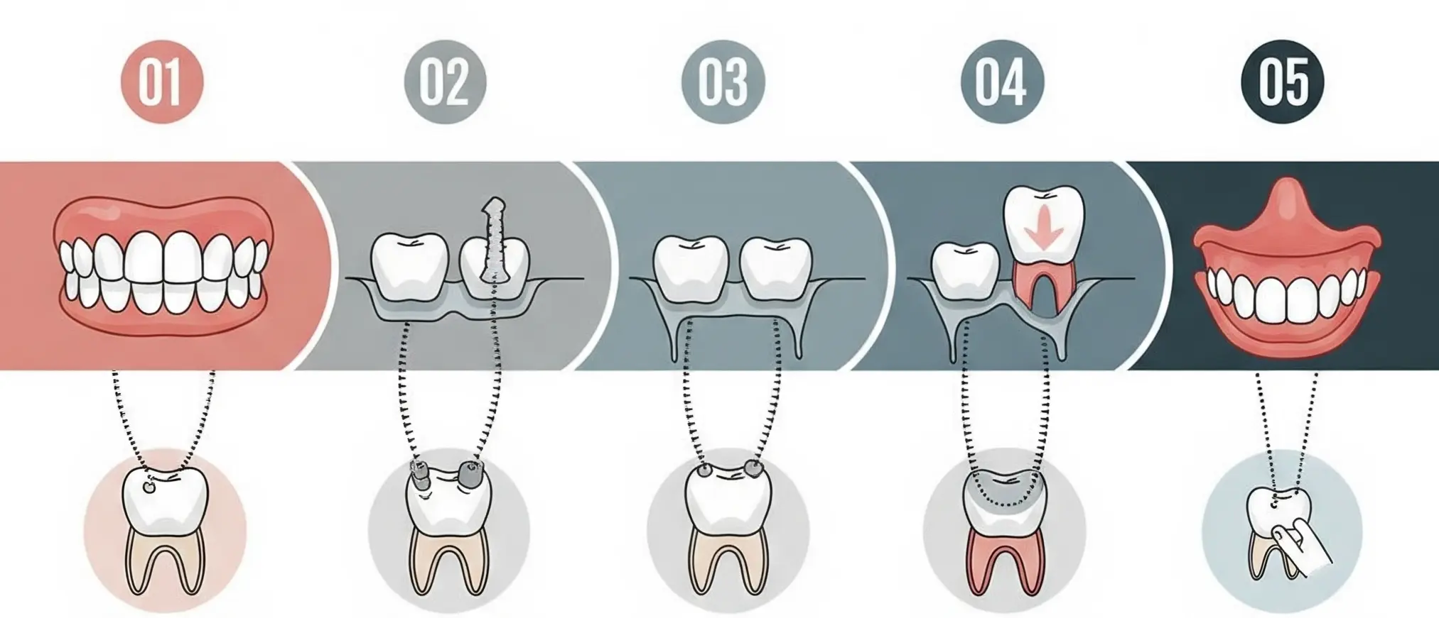 Bridges 2 2025 December Dentist in West Byfleet, Surrey | York House Dental Practice