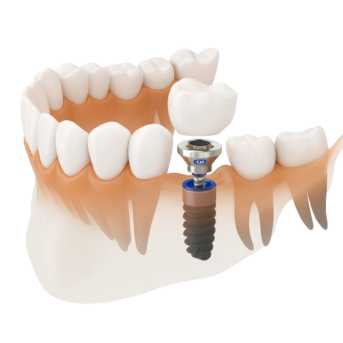 ChatGPT Image Dec 6 2025 12 44 32 PM removebg preview York House Dental Practice 2026 February